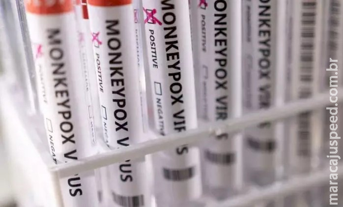 Capital tem 2º caso suspeito de varíola do macaco em isolamento