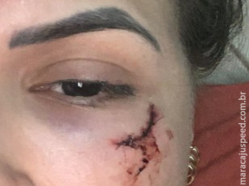 “Inconsciente em poça de sangue”, estudante denuncia ex-namorado “Inconsciente em poça de sangue”, estudante denuncia ex-namorado