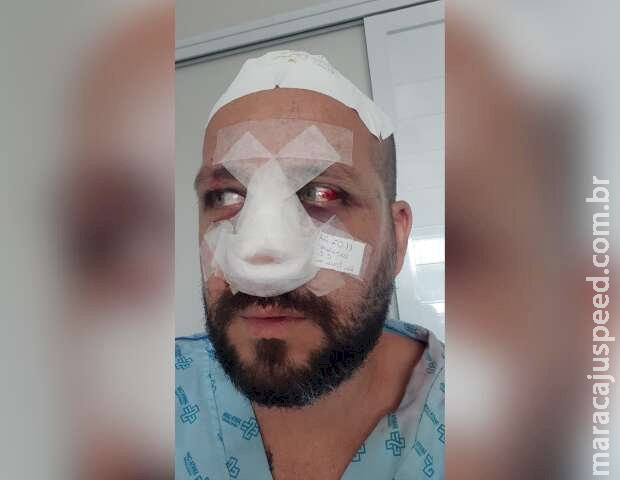 “Não achei que ia sobrar pra mim”, diz motorista agredido por 3 homens