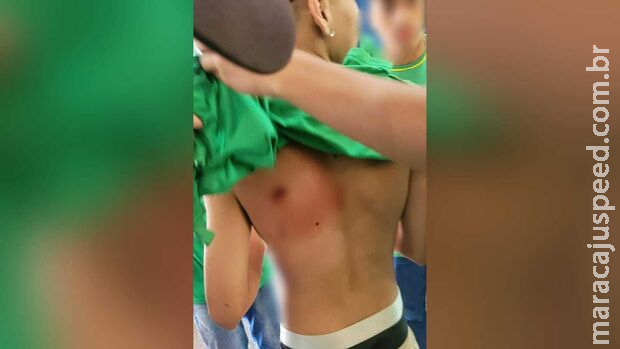 Aluno é esfaqueado em escola de Ponta Porã Aluno é esfaqueado em escola de Ponta Porã