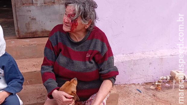 Avó deixa neto morar de favor em casa, e acaba agredida a pauladas em Campo Grande Avó deixa neto morar de favor em casa, e acaba agredida a pauladas em Campo Grande