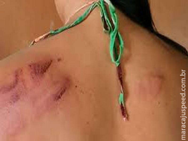 Briga entre cafetina e travesti acaba com mulher ferida a golpes de facão Briga entre cafetina e travesti acaba com mulher ferida a golpes de facão