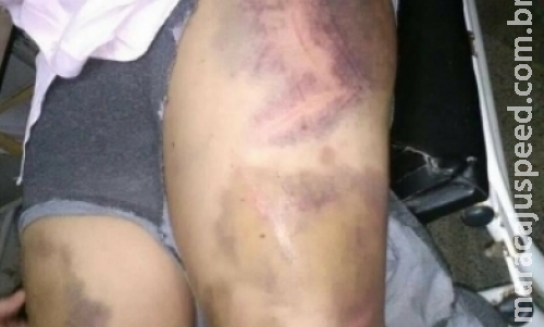 Mulher é espancada após discutir com desconhecido em pagode de Corumbá Mulher é espancada após discutir com desconhecido em pagode de Corumbá
