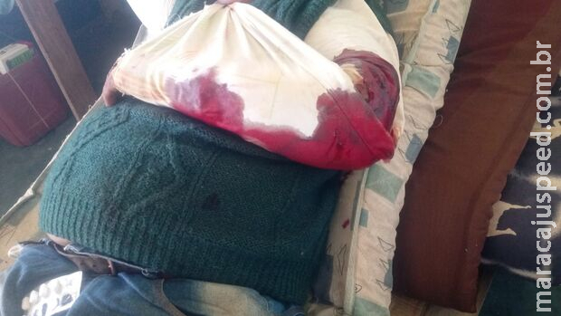 Peão prende braço em trator e é salvo por helicóptero dos Bombeiros no Pantanal Peão prende braço em trator e é salvo por helicóptero dos Bombeiros no Pantanal