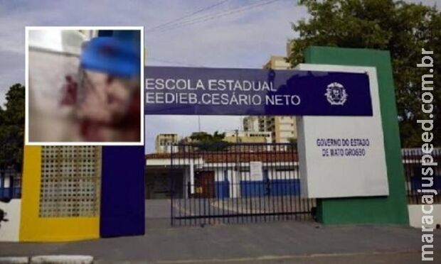 Estudante é ferida a canetadas dentro de sala de aula no MT Estudante é ferida a canetadas dentro de sala de aula no MT