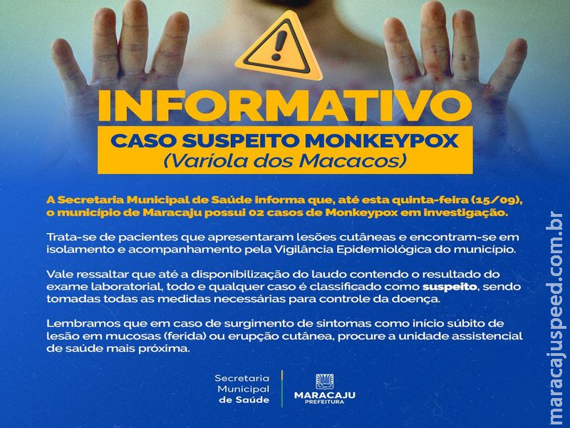Prefeitura de Maracaju informa que município conta com dois casos suspeitos da “Monkeypox”