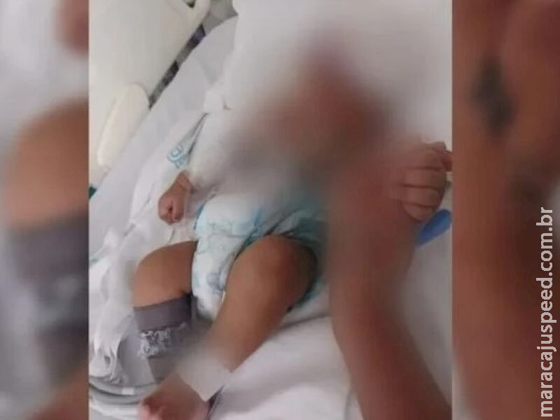 Bebê de dois meses morre após ser atingido no rosto por um celular