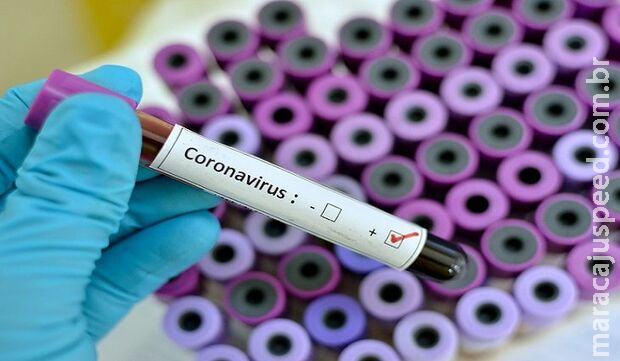 Em uma semana, MS soma 954 novos casos e duas mortes por Covid-19 Em uma semana, MS soma 954 novos casos e duas mortes por Covid-19