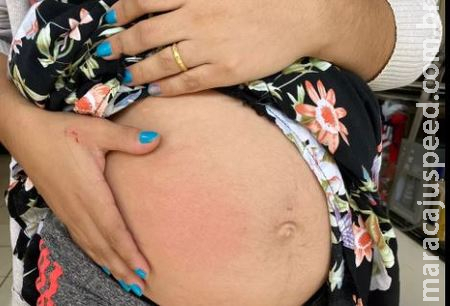 Grávida de 9 meses, menor de 17 anos recebe tapas no rosto e murro na barriga no centro de Sidrolândia Grávida de 9 meses, menor de 17 anos recebe tapas no rosto e murro na barriga no centro de Sidrolândia