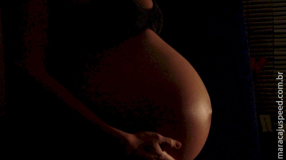 Médico repudia decisões que impediram aborto de grávida de siameses Médico repudia decisões que impediram aborto de grávida de siameses