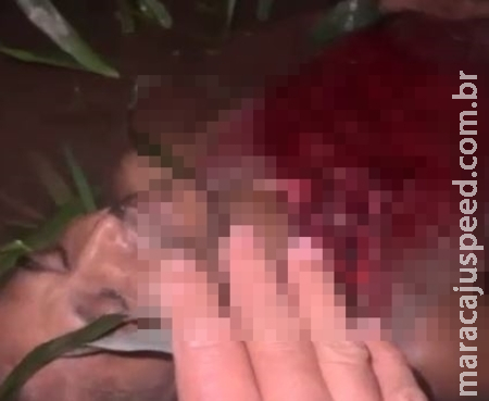 Ataque brutal de onça contra caseira de sítio deixa exposto coração da vítima batendo Ataque brutal de onça contra caseira de sítio deixa exposto coração da vítima batendo