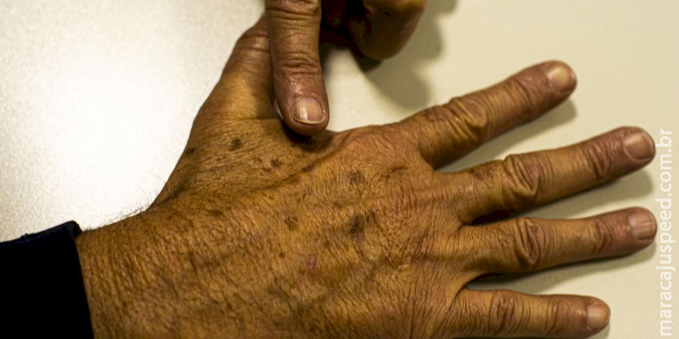 Brasil terá 704 mil novos casos de câncer por ano até 2025, diz Inca Brasil terá 704 mil novos casos de câncer por ano até 2025, diz Inca