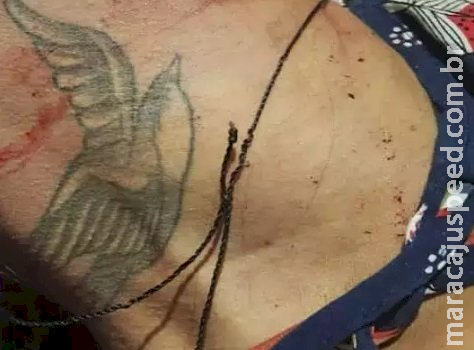 Morta em acidente de trânsito não usava capacete e quebrou o pescoço Morta em acidente de trânsito não usava capacete e quebrou o pescoço