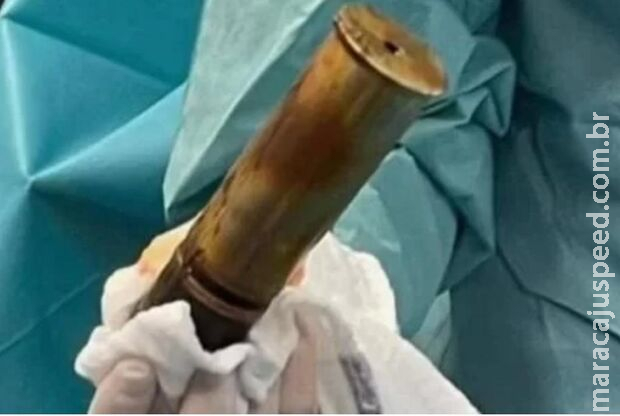 Hospital é evacuado após idoso chegar no local com bomba no ânus Hospital é evacuado após idoso chegar no local com bomba no ânus