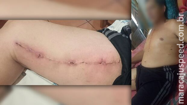Paciente com cirurgia infeccionada fica exposto no Pronto-Socorro por falta de leitos Paciente com cirurgia infeccionada fica exposto no Pronto-Socorro por falta de leitos