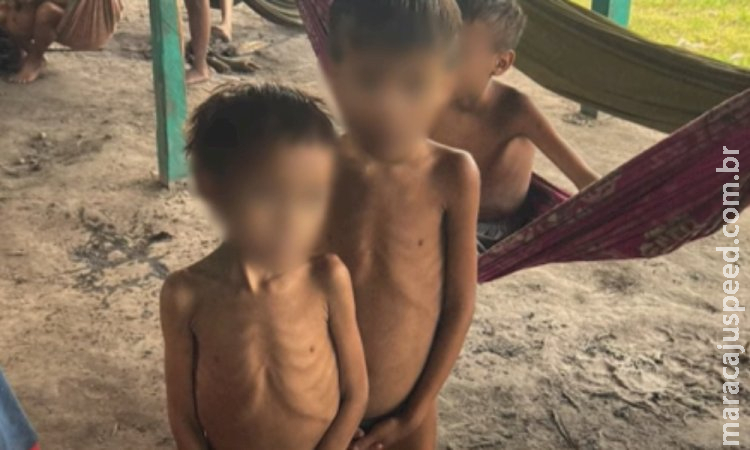 Ministério da Saúde decreta emergência em Saúde Pública no território Yanomami, em Roraima