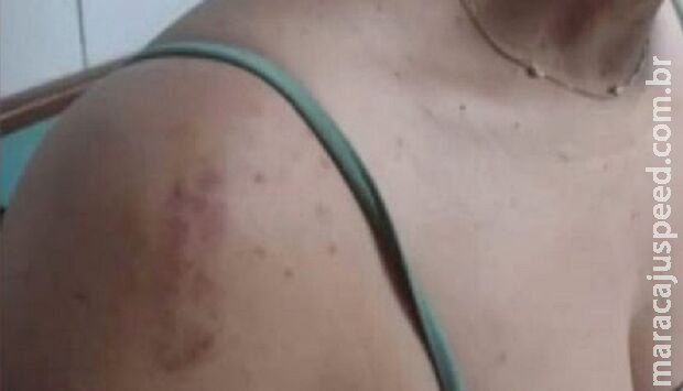 Para se defender de agressões, mulher dá 3 facadas no esposo na Vila Entroncamento