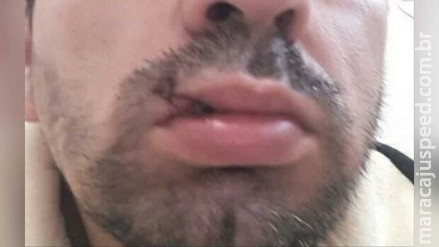 Dono de boteco agride filho de cliente falecido por dívida de R$ 50 em Campo Grande