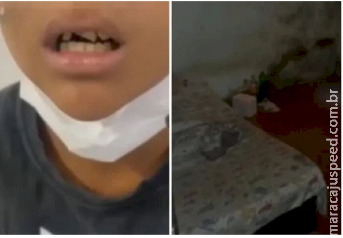 Homem de 27 anos quebra dentes e ossos da Homem de 27 anos quebra dentes e ossos da