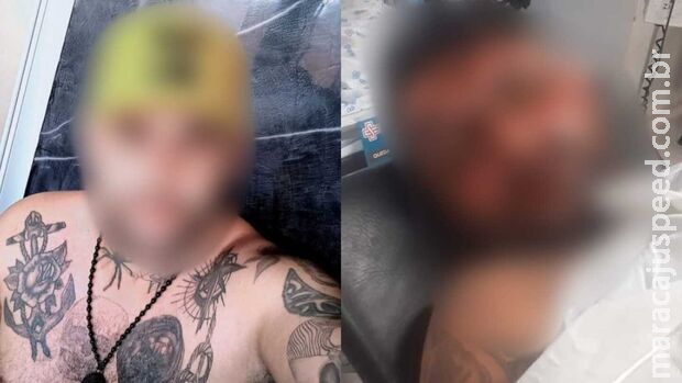 Tatuador fica cego e família pede prisão de ex-enciumada: Tatuador fica cego e família pede prisão de ex-enciumada:
