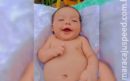 Bebê de 2 meses morre após receber colírio ao invés de remédio para enjoo Bebê de 2 meses morre após receber colírio ao invés de remédio para enjoo