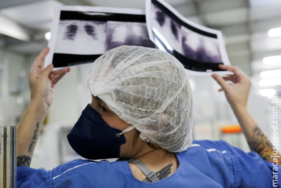 Casos de tuberculose aumentam 27,3% em Mato Grosso do Sul Casos de tuberculose aumentam 27,3% em Mato Grosso do Sul