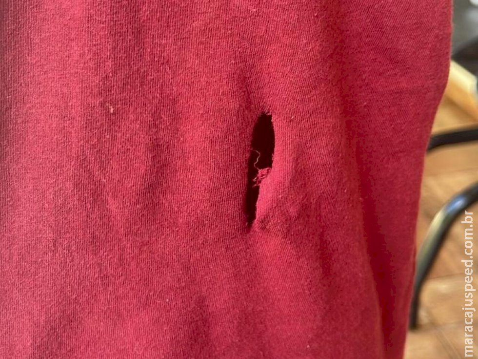 Crianças são atacadas por cachorro Pitbull em Dourados