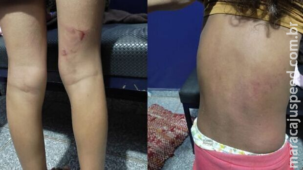 Justiça decreta prisão preventiva de casal por espancar crianças em Chapadão do Sul