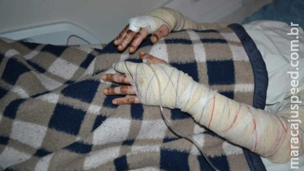 Mulher ferve água e queima marido no Jardim Canguru Mulher ferve água e queima marido no Jardim Canguru
