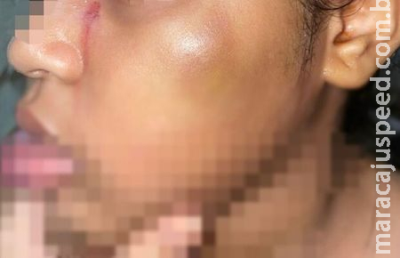 Pai tortura filha pequena com faca quente e pimenta no ouvido