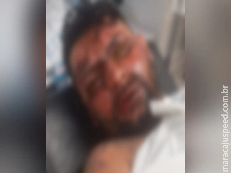 Homens também são vítimas e violência doméstica contra eles já atingiu 5 mil casos em MS