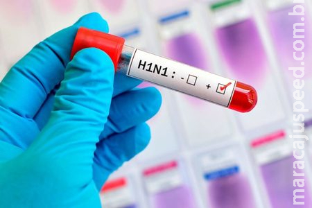 Casos de H1N1 crescem entre adultos; diagnósticos de covid-19 caem