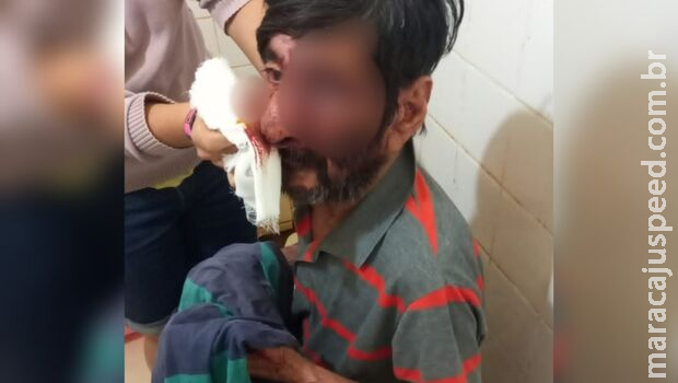 Em surto psicótico, homem desfigura rosto do pai com arma branca Em surto psicótico, homem desfigura rosto do pai com arma branca