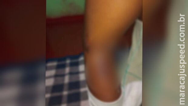 Menino de 4 anos revela que mãe jogava pedra e bicicleta nele em Chapadão do Sul