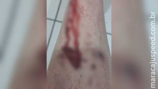Mulher atacada por cachorro no Aero Rancho ficou com lesão grave