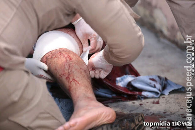 Mulher briga e mete facada no marido em Dourados