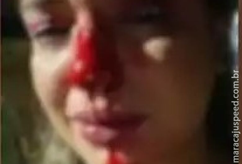 Preso após espancar ex-mulher, assessor parlamentar é demitido