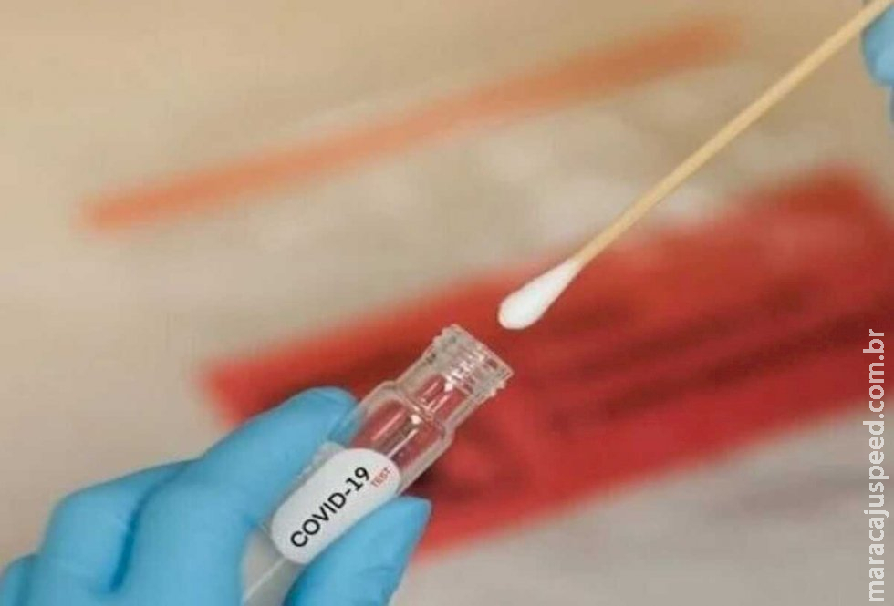 Duas mulheres morrem por Covid em semana com mais de 400 testes positivos