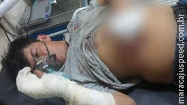 Homem bate sem querer em portão, e dono da casa o ataca com churrasqueira Homem bate sem querer em portão, e dono da casa o ataca com churrasqueira