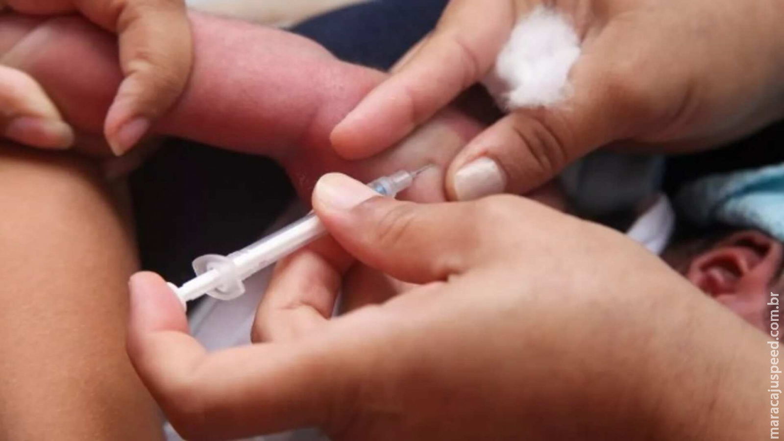 3 casos confirmados: O que é a coqueluche e por que preocupa a saúde de Mato Grosso do Sul? 3 casos confirmados: O que é a coqueluche e por que preocupa a saúde de Mato Grosso do Sul?