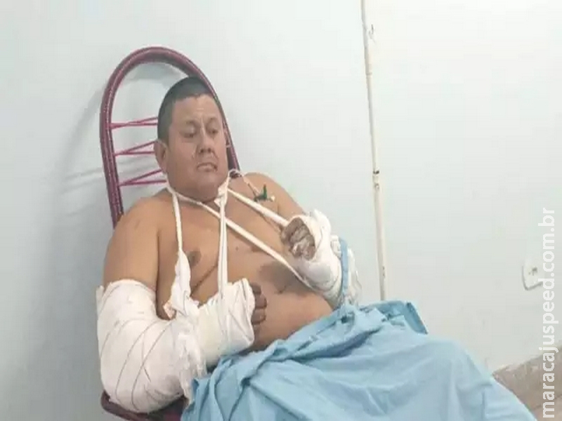 A 3 dias de aniversário, trabalhador atacado por onça diz que “nasceu de novo” - CREDITO: CAMPO GRANDE NEWS A 3 dias de aniversário, trabalhador atacado por onça diz que “nasceu de novo” - CREDITO: CAMPO GRANDE NEWS