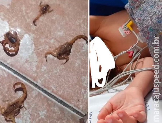Criança picada por escorpião é transferida para Campo Grande em estado grave