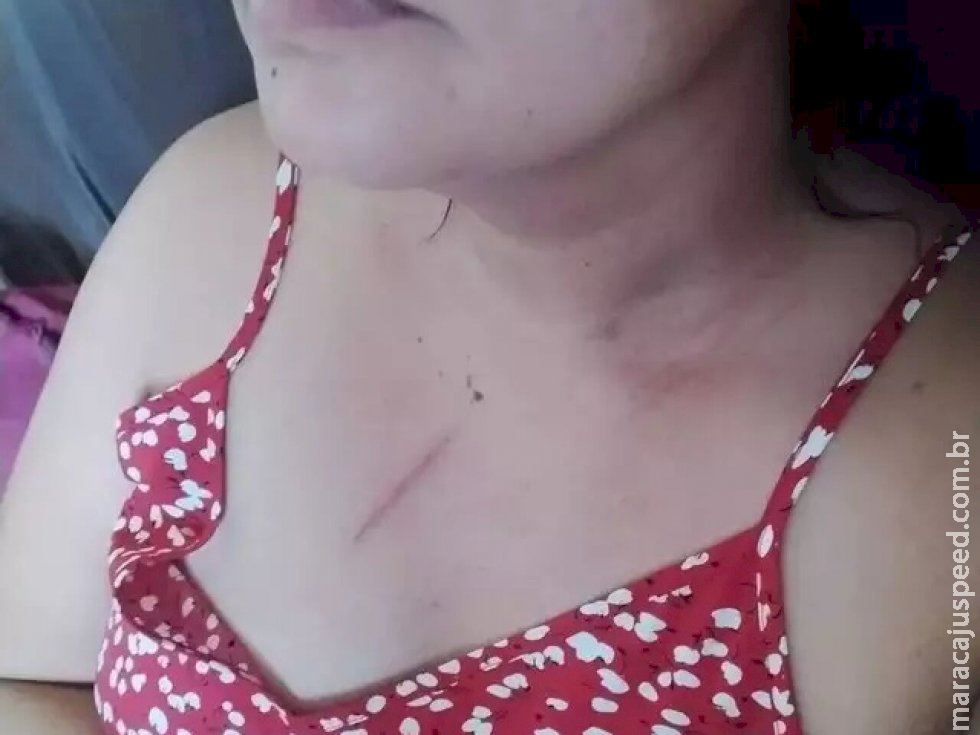 Homem é preso suspeito de agredir a irmã vereadora Homem é preso suspeito de agredir a irmã vereadora