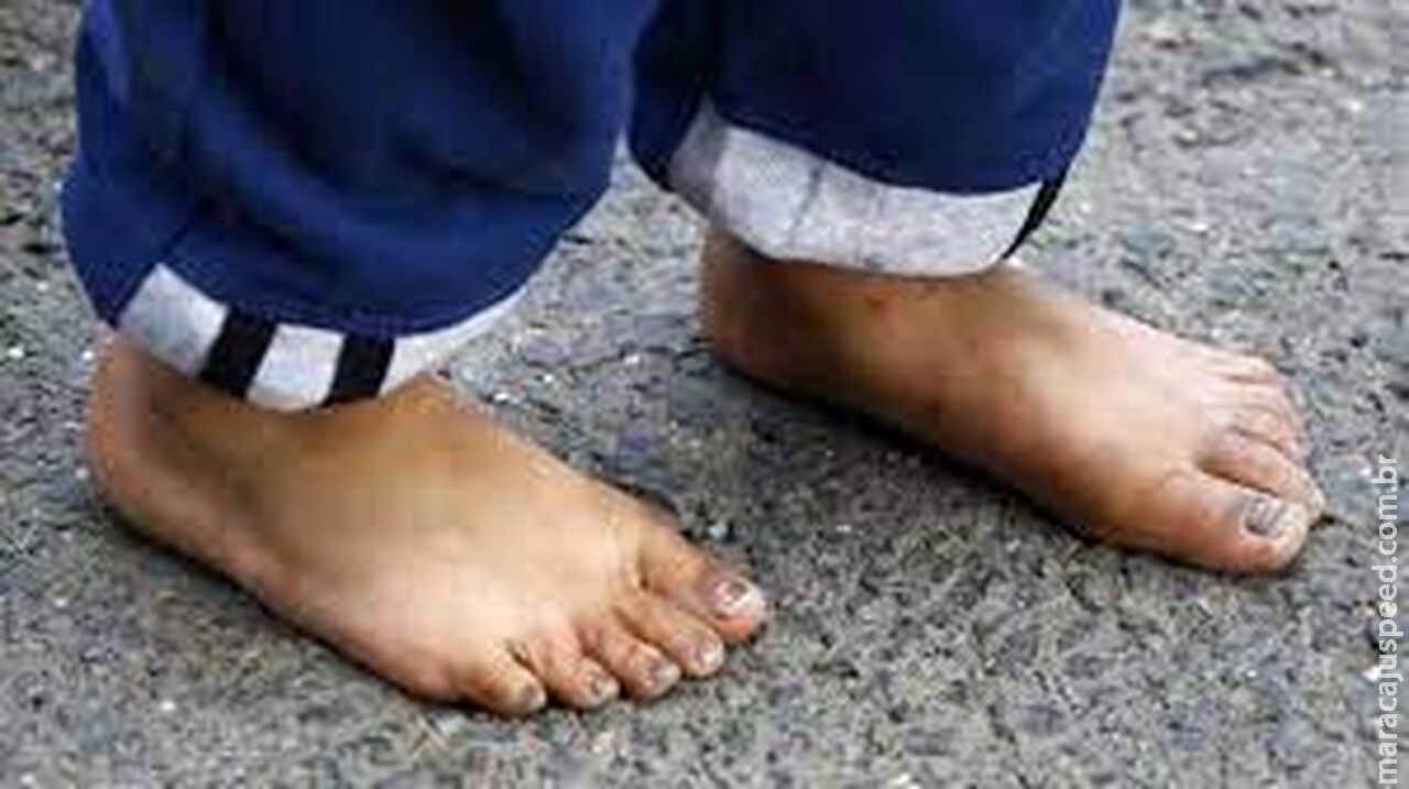 Menino de 5 anos é espancado com concha de cozinha por mãe que acaba na delegacia Menino de 5 anos é espancado com concha de cozinha por mãe que acaba na delegacia