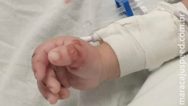 Bebê de apenas 10 meses sofre tortura e é internado com traumatismo craniano e anemia