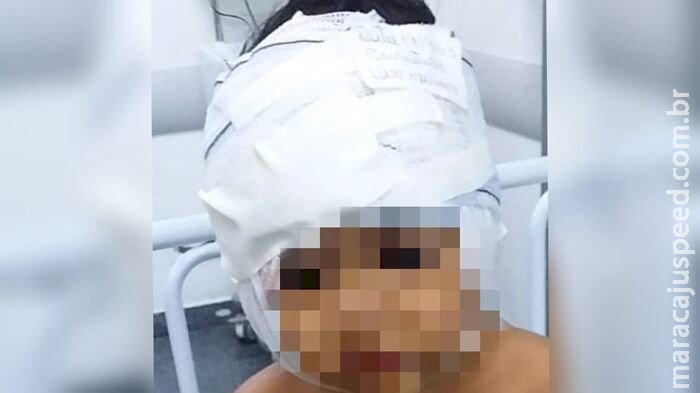 Criança atacada por Pitbull em Ribas recebe alta após ficar uma semana internada 