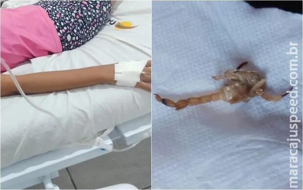 Picada por escorpião em Ribas, criança de 3 anos está em estado grave na Santa Casa 