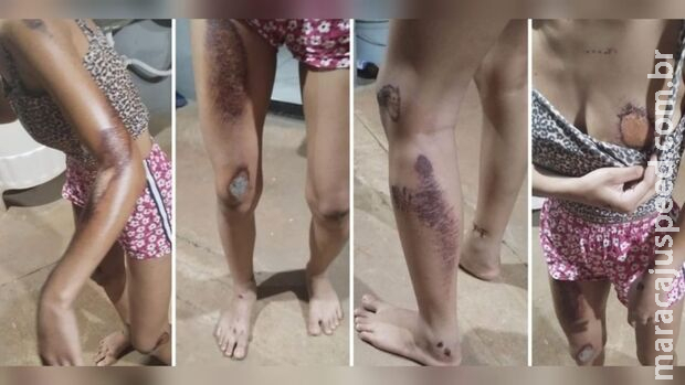 Rapaz empina de moto, atropela adolescente e família se revolta em Nova Andradina