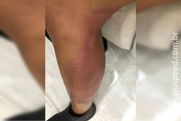 Administradora regional é espancada com pedaço de madeira por marido