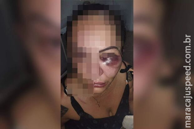 Homem agride, enforca e desfigura rosto de mulher no DF